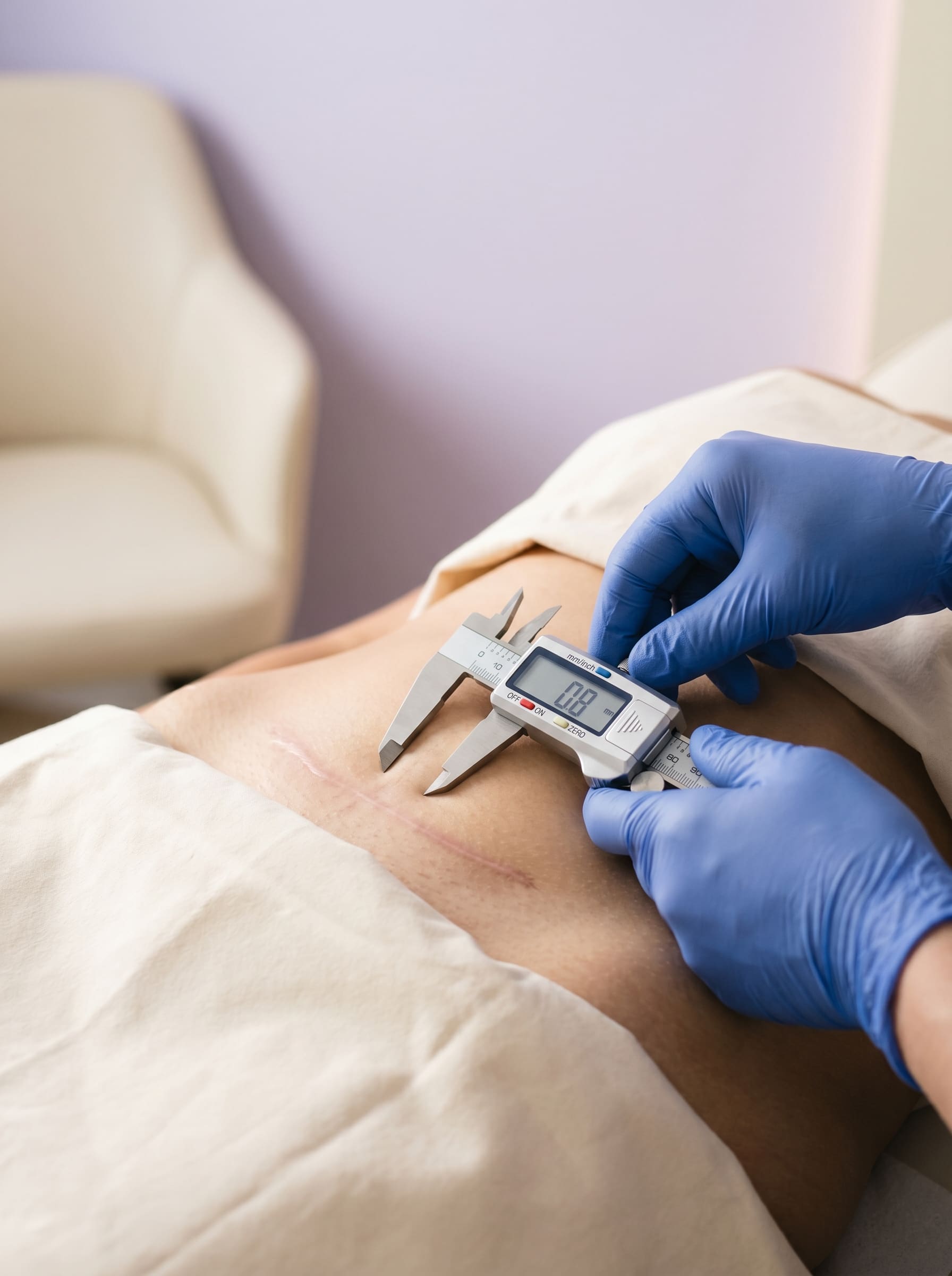 Scarring & Fibrosis